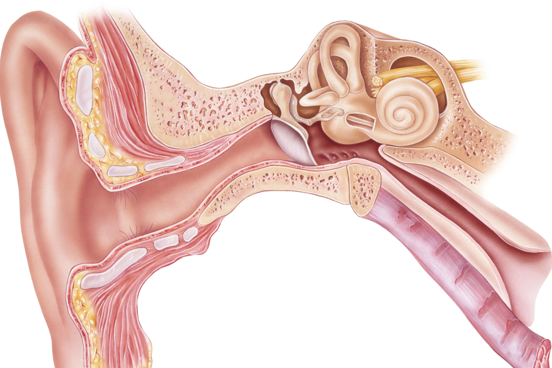 Izlivno vnetje srednjega ušesa